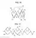 Fig. 06 - SIX CELL INNER STENT DEVICE FOR PROSTHETIC MITRAL VALVES