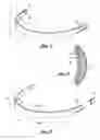 Fig. 02 - TEMPORARY PERIODONTAL PROSTHETIC DEVICE THAT GIVES THE APPEARANCE OF FULLER LIPS