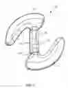 Fig. 06 - Graft fixation
