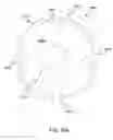 Fig. 33 - Graft fixation