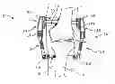 Fig. 01 - Methods of Implanting Transcutaneous Joint Unloading Devices
