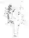 Fig. 02 - Methods of Implanting Transcutaneous Joint Unloading Devices
