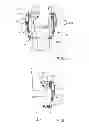 Fig. 04 - Methods of Implanting Transcutaneous Joint Unloading Devices