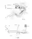 Fig. 06 - Methods of Implanting Transcutaneous Joint Unloading Devices