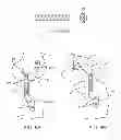 Fig. 07 - Methods of Implanting Transcutaneous Joint Unloading Devices