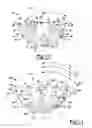 Fig. 05 - Shoulder prosthesis
