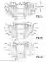 Fig. 08 - Shoulder prosthesis