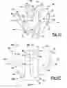 Fig. 12 - Shoulder prosthesis