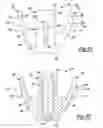 Fig. 13 - Shoulder prosthesis
