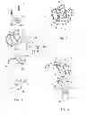 Fig. 02 - TOTAL KNEE PROSTHESIS, AND SET OF MODULAR ELEMENTS MAKING  IT POSSIBLE TO OBTAIN SUCH A PROSTHESIS