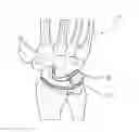 Fig. 01 - Method of reconstructing a patient's wrist