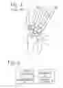 Fig. 02 - Method of reconstructing a patient's wrist