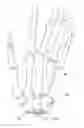 Fig. 01 - Prosthesis