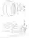 Fig. 07 - Prosthesis