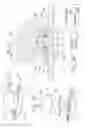 Fig. 08 - Prosthesis