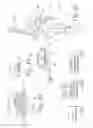 Fig. 09 - Prosthesis