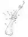 Fig. 01 - METHODS AND APPARATUS FOR A MULTIPLE TRANSITION TEMPERATURE IMPLANT