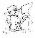 Fig. 07 - METHODS AND APPARATUS FOR A MULTIPLE TRANSITION TEMPERATURE IMPLANT