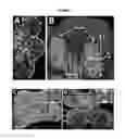 Fig. 02 - Method for modulating the number of archesporial cells in a developing anther