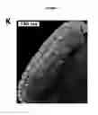 Fig. 07 - Method for modulating the number of archesporial cells in a developing anther