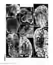 Fig. 41 - Method for modulating the number of archesporial cells in a developing anther
