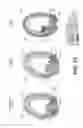Fig. 41 - Sucrose Transporters and Methods of Generating Pathogen-Resistant Plants