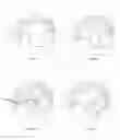 Fig. 09 - Slicing apparatus and method of use thereof