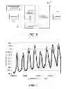 Fig. 05 - Dendrometer