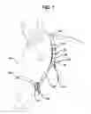 Fig. 02 - Adjustable halter