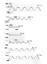 Fig. 30 - Filter arrangements; housings; assemblies; and, methods