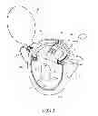 Fig. 04 - TEA INFUSER STRUCTURE
