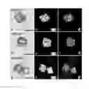 Fig. 32 - Organic-Inorganic Composite Materials as a Result of Biomineralization