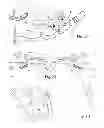 Fig. 08 - Archery bow, floating limb compound (FLC)