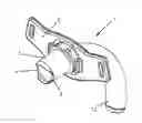 Fig. 01 - ARRANGEMENT IN THE FORM OF A TRACHEOSTOMA PROSTHESIS FOR EASY INSERTION AND EASY REMOVAL OF AN INNER CANNULA
