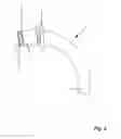 Fig. 03 - ARRANGEMENT IN THE FORM OF A TRACHEOSTOMA PROSTHESIS FOR EASY INSERTION AND EASY REMOVAL OF AN INNER CANNULA
