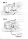 Fig. 02 - APNEA TREATMENT METHOD AND DEVICE