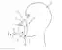 Fig. 01 - PATIENT INTERFACE DEVICE