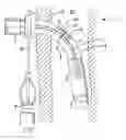 Fig. 01 - Tracheostomy tubes