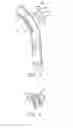 Fig. 04 - Tracheostomy tubes