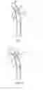 Fig. 05 - Tracheostomy tubes