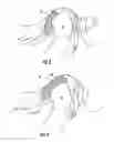 Fig. 07 - Concussion retarding orthotic and method of producing the orthotic