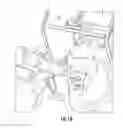 Fig. 08 - Concussion retarding orthotic and method of producing the orthotic