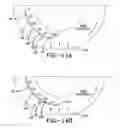 Fig. 14 - Distributed cavity air pumping assembly and method for a tire