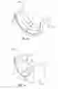 Fig. 10 - SPLIT SLEEVES FOR ROLLING CUTTERS
