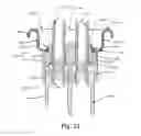 Fig. 19 - Multi-valve delivery system