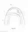 Fig. 14 - Fan orifice dispensing closure