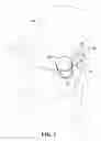 Fig. 03 - Apparatus for supporting a food item