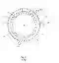 Fig. 08 - Direct-drive wind turbine