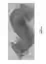 Fig. 04 - Systems and methods of waveguide assembly using longitudinal features