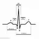 Fig. 01 - Device and method for continuous biometric recognition based on electrocardiographic signals